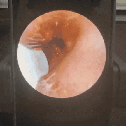 Auricla Vision Pro - L'hygiène auditive réinventée